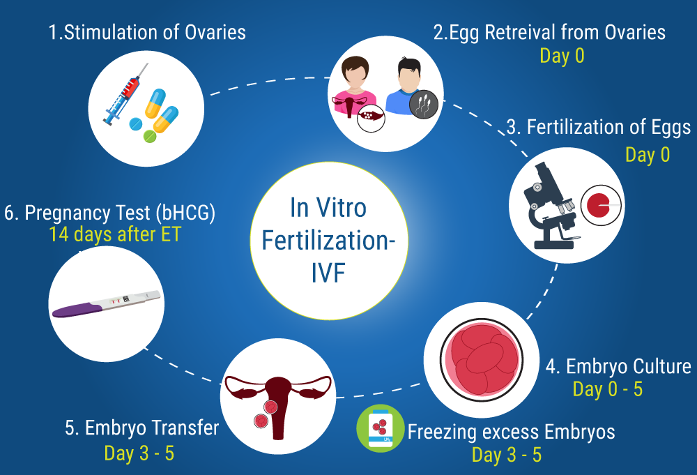 In Vitro Fertilization IVF Mediologiest