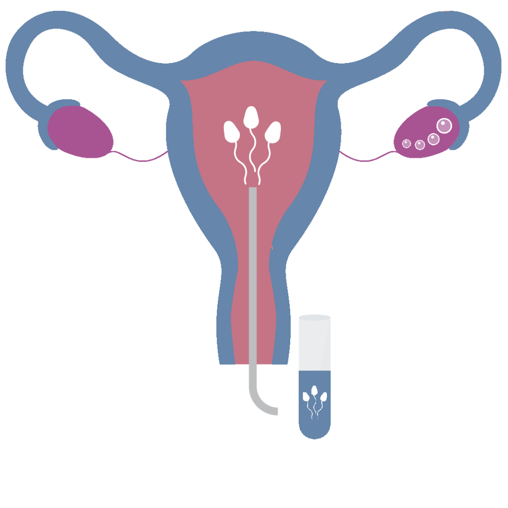 Iui Lab Requirements