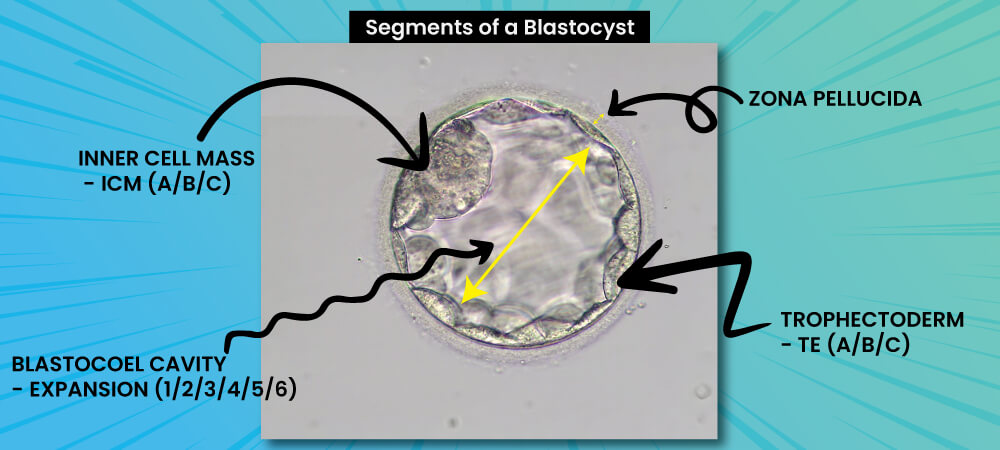 SegmentsOfBlastocystEmbryo