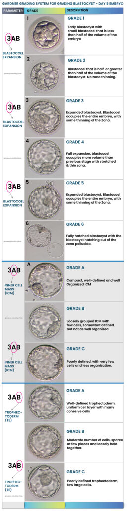 Gardner Grading System for Blastocyst